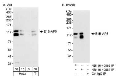 Western Blot: HNRNPUL1 Antibody [NB110-40587] - Detection of Human E1B-AP5 on HeLa whole cell lystate using NB110-40587. E1B-AP5 was also immunoprecipitated by rabbit anti-E1B-AP5 NB110-40586.