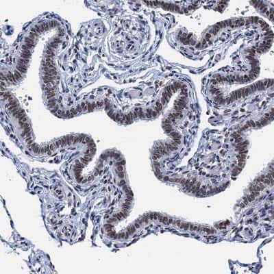 Immunohistochemistry-Paraffin: HNRNPUL2 Antibody [NBP1-92001] - Staining of human fallopian tube shows weak to moderate nuclear positivity in glandular cells.