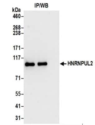 Immunoprecipitation: HNRNPUL2 Antibody [NBP2-37687] - Whole cell lysate (0.5 or 1.0 mg per IP reaction; 20% of IP loaded) from 293T cells prepared using NETN lysis buffer.  Affinity purified rabbit anti-HNRNPUL2 antibody  used for IP at 6 ug per reaction.  HNRNPUL2 was also immunoprecipitated by rabbit anti-HNRNPUL2 antibody.  For blotting immunoprecipitated HNRNPUL2, was used at 0.1 ug/ml.  Detection: Chemiluminescence with an exposure time of 10 seconds.