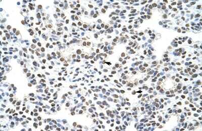 Immunohistochemistry-Paraffin HNRPA3 Antibody