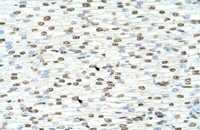 Immunohistochemistry-Paraffin: HNRPA3 Antibody [NBP1-80487] - Human Heart Tissue, antibody concentration 4-8ug/ml. Cells with positive label: Myocardial cells (indicated with arrows) 400X magnification.