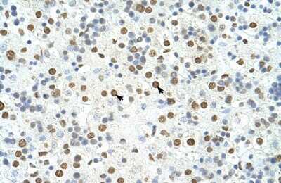 Immunohistochemistry-Paraffin: HNRPA3 Antibody [NBP1-80487] - Human Liver Tissue, antibody concentration 4-8ug/ml. Cells with positive label: Hepatocytes (indicated with arrows) 400X magnification.