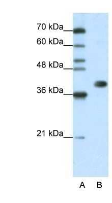 Western Blot HNRPA3 Antibody