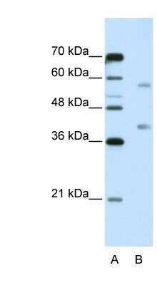 Western Blot: HNRPA3 Antibody [NBP1-80487] - Jurkat cell lysate, Antibody Titration: 5.0ug/ml
