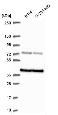 Western Blot: HNRPA3 Antibody [NBP2-56989] - Western blot analysis in human cell line RT-4 and human cell line U-251 MG.