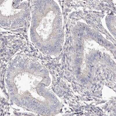 <b>Orthogonal Strategies Validation. </b>Immunohistochemistry-Paraffin: HNRPGT Antibody [NBP1-92000] - Staining of human endometrium shows low expression as expected.