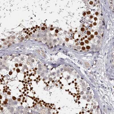 Immunohistochemistry-Paraffin: HNRPGT Antibody [NBP1-92000] - Staining of human testis shows high expression.