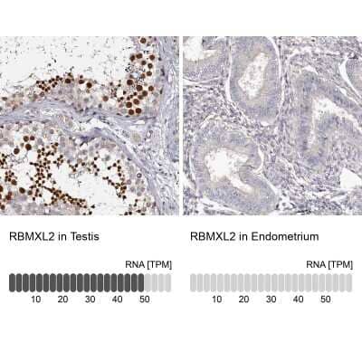 Immunohistochemistry-Paraffin HNRPGT Antibody - BSA Free