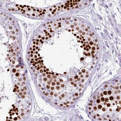 Immunohistochemistry-Paraffin: HNRPGT Antibody [NBP2-13211] Staining of human testis shows strong nuclear positivity in cells in seminiferus ducts.