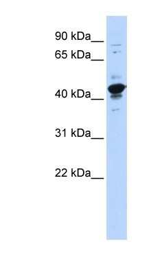 Western Blot: HNRPGT Antibody [NBP1-57164] - 293T cells lysate, concentration 0.2-1 ug/ml.