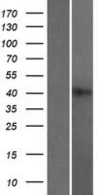 Western Blot: HNRPGT Overexpression Lysate (Adult Normal) [NBP2-10317] Left-Empty vector transfected control cell lysate (HEK293 cell lysate); Right -Over-expression Lysate for HNRPGT.