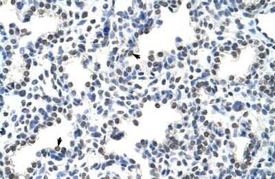 Immunohistochemistry-Paraffin HNRPLL Antibody