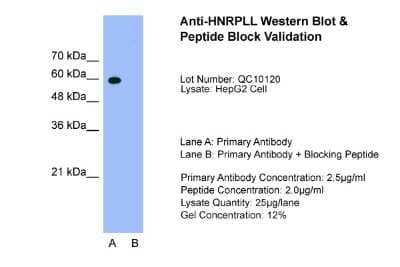 Western Blot HNRPLL Antibody