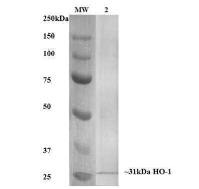 Western Blot: HO-1/HMOX1/HSP32 Antibody (6B8-2F2) [NBP2-59338] - Analysis of Human, Mouse, Rat Rat Kidney Lysate showing detection of ~31 kDa HO-1 protein using Mouse Anti-HO-1 Monoclonal Antibody, Clone 6B8-2F2. Lane 1: MW Ladder. Lane 2: Rat Kidney Lysate. Block: 5% milk + TBST for 1 hour at RT. Primary Antibody: Mouse Anti-HO-1 Monoclonal Antibody at 1:1000 for 1 hour at RT. Secondary Antibody: HRP Goat Anti-Mouse at 1:50 for 1 hour at RT. Color Development: TMB solution for 5 min at RT. Predicted/Observed Size: ~31 kDa.