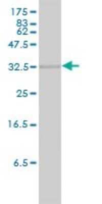 Western Blot: HO-2/HMOX2 Antibody (1D8-1A8) [H00003163-M01] - HMOX2 monoclonal antibody (M01), clone 1D8-1A8. Analysis of HMOX2 expression in human spleen.