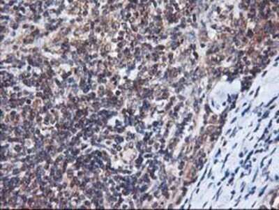 Immunohistochemistry: HO-2/HMOX2 Antibody (OTI1C2) - Azide and BSA Free [NBP2-70895] - Staining of paraffin-embedded Human lymphoma tissue using anti-Heme oxygenase 2 mouse monoclonal antibody.