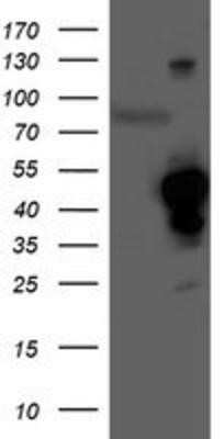 Western Blot: HO-2/HMOX2 Antibody (OTI1C2) - Azide and BSA Free [NBP2-70895] - HEK293T cells were transfected with the pCMV6-ENTRY control (Left lane) or pCMV6-ENTRY Heme oxygenase 2 (Right lane) cDNA for 48 hrs and lysed. Equivalent amounts of cell lysates (5 ug per lane) were separated by SDS-PAGE and immunoblotted with anti-Heme