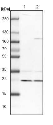 Western Blot: HO-2/HMOX2 Antibody [NBP1-91981] - Lane 1: NIH-3T3 cell lysate (Mouse embryonic fibroblast cells). Lane 2: NBT-II cell lysate (Rat Wistar bladder tumor cells).