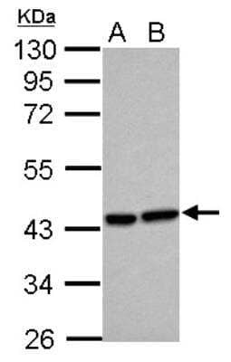 Western Blot: HO-2/HMOX2 Antibody [NBP2-16804] - Sample (30 ug of whole cell lysate) A: HeLa B: HepG2 10% SDS PAGE gel, diluted at 1:500.