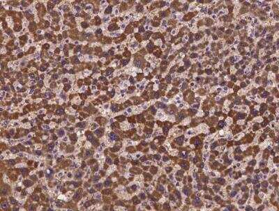 Immunohistochemistry-Paraffin HOGA1 Antibody