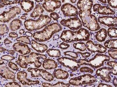 Immunohistochemistry-Paraffin HOGA1 Antibody