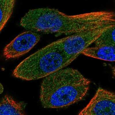 Immunocytochemistry/Immunofluorescence: HOIP/RNF31 Antibody [NBP2-48914] - Staining of human cell line PC-3 shows localization to cytosol. Antibody staining is shown in green.