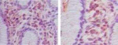 Immunohistochemistry HOIP/RNF31 Antibody