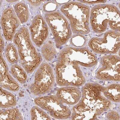 Immunohistochemistry-Paraffin: HOIP/RNF31 Antibody [NBP2-48914] - Staining of human kidney shows strong cytoplasmic and membranous positivity in cells in tubules.