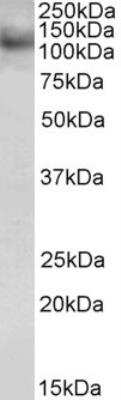 Western Blot: HOIP/RNF31 Antibody [NB100-1094] -  (0.5ug/ml) staining of JURKAT lysate (35ug protein in RIPA buffer). Primary incubation was 1 hour. Detected by chemiluminescence.