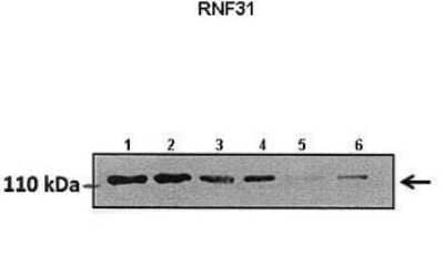 Western Blot: HOIP/RNF31 Antibody [NBP1-55059] - Lanes: Lane1 : 50 ug hormoxia A549 lysate Lane2: 50 ug hypoxia A549 lysate Lane3: 50 ug hormoxia A549 lysate (+scrambled siRNA) Lane4: 50 ug hypoxia A549 lysate (+scrambled siRNA) Lane5: 50 ug hormoxia A549 lysate (RNF31 siRNA) Lane6: 50 ug hypoxia A549 lysate (RNF31 siRNA) Primary, Antibody Dilution: 1 : 800 Secondary Antibody: Goat anti rabbit HRP Secondary, Antibody Dilution: 1 : 10000 Gene name: RNF31.