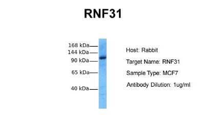 Western Blot: HOIP/RNF31 Antibody [NBP1-55059] - Sample Tissue: Human MCF7 Antibody Dilution: 1.0 ug/ml