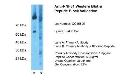 Western Blot: HOIP/RNF31 Antibody [NBP1-55059] - Sample Type: Jurkat Whole Cell Lane A: Primary Antibody Lane B: Primary Antibody + Blocking Peptide Primary Antibody Concentration: 1 ug/ml Peptide Concentration: 5 ug/ml Lysate Quantity: 25 ug/lane/Lane Gel Concentration: 0.12