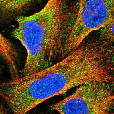 Immunocytochemistry/Immunofluorescence: HOMER1 Antibody [NBP2-38309] - Immunofluorescent staining of human cell line U-2 OS shows localization to cytosol.