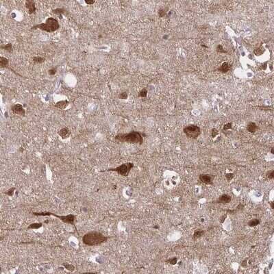 Immunohistochemistry-Paraffin: HOMER1 Antibody [NBP2-38309] - Staining of human cerebral cortex shows strong cytoplasmic and nuclear positivity in neuronal cells.