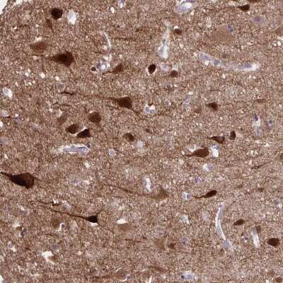 Immunohistochemistry-Paraffin: HOMER1 Antibody [NBP2-38308] - Staining of human cerebral cortex shows high expression.