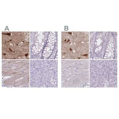 <b>Independent Antibodies Validation. </b>Immunohistochemistry-Paraffin: HOMER1 Antibody [NBP2-38308] - Staining of human cerebral cortex, colon, heart muscle and pancreas using Anti-HOMER1 antibody NBP2-38308 (A) shows similar protein distribution across tissues to independent antibody NBP2-38309 (B).