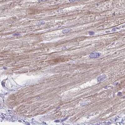 Immunohistochemistry-Paraffin: HOMER1 Antibody [NBP2-38308] - Staining of human heart muscle.