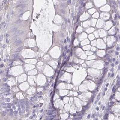 Immunohistochemistry-Paraffin: HOMER1 Antibody [NBP2-38308] - Staining of human colon.