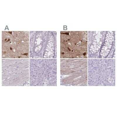 <b>Independent Antibodies Validation and Orthogonal Strategies Validation.</b>Immunohistochemistry-Paraffin: HOMER1 Antibody [NBP2-38309] - Staining of human cerebral cortex, colon, heart muscle and pancreas using Anti-HOMER1 antibody NBP2-38309 (A) shows similar protein distribution across tissues to independent antibody NBP2-38308 (B).