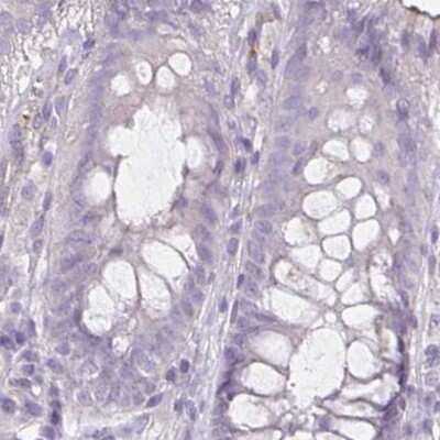 Immunohistochemistry-Paraffin: HOMER1 Antibody [NBP2-38309] - Staining of human colon.