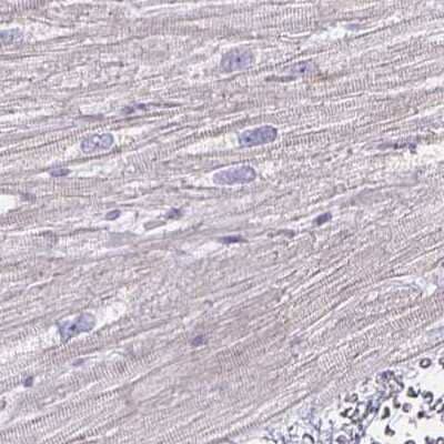 Immunohistochemistry-Paraffin: HOMER1 Antibody [NBP2-38309] - Staining of human heart muscle.