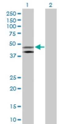 Western Blot: HOMER1 Antibody [H00009456-D01P] - Analysis of HOMER1 expression in transfected 293T cell line by HOMER1 polyclonal antibody.Lane 1: HOMER1 transfected lysate(40.30 KDa).Lane 2: Non-transfected lysate.