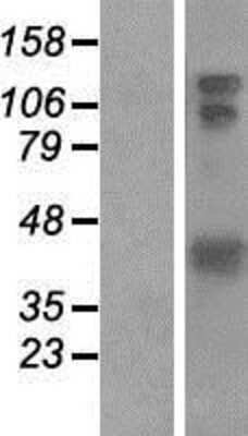 Western Blot HOMER1 Overexpression Lysate