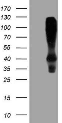 Western Blot: HOMER2 Antibody (OTI1H3) - Azide and BSA Free [NBP2-71465] - HEK293T cells were transfected with the pCMV6-ENTRY control (Left lane) or pCMV6-ENTRY HOMER2 (Right lane) cDNA for 48 hrs and lysed. Equivalent amounts of cell lysates (5 ug per lane) were separated by SDS-PAGE and immunoblotted with anti-HOMER.