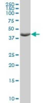 Western Blot HOMER3 Antibody