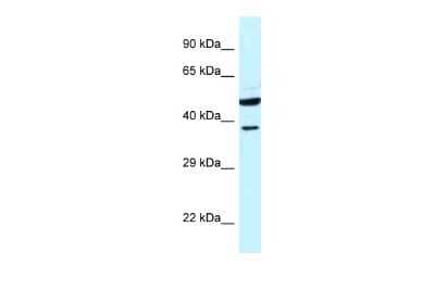 Western Blot HOMER3 Antibody