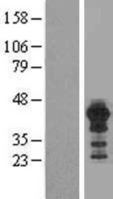 Western Blot HOMER3 Overexpression Lysate