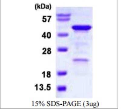 SDS-PAGE Recombinant Human HOMER3 His Protein