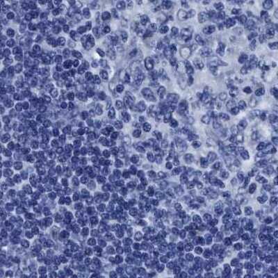 Immunohistochemistry-Paraffin: HOOK1 Antibody [NBP1-81745] - Staining of human lymph node.