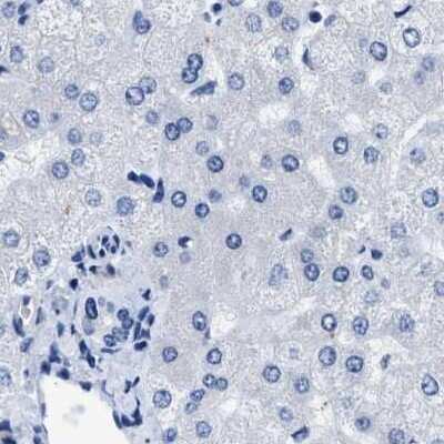 Immunohistochemistry-Paraffin: HOOK1 Antibody [NBP1-81745] - Staining of human liver.